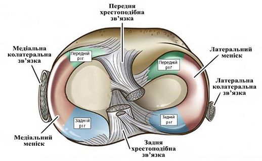 схема колінного суглоба при пошкодженні меніску
